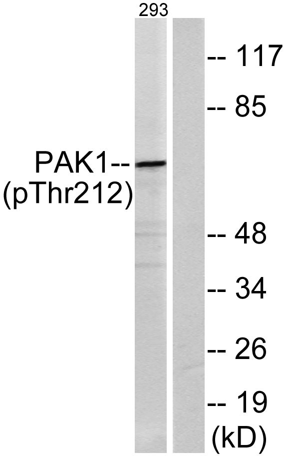 Western blot analysis of lysates from 293 cells treated with etoposide 25uM 1h, using PAK1 (Phospho-Thr212) Antibody