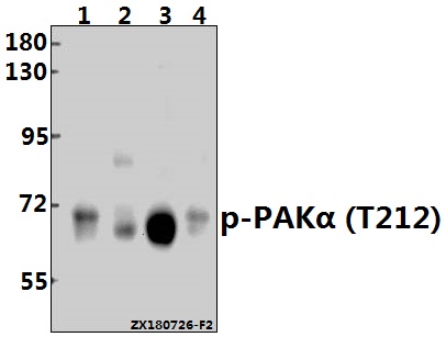 a00454t212 pak1 primary antiboties wb testing 1