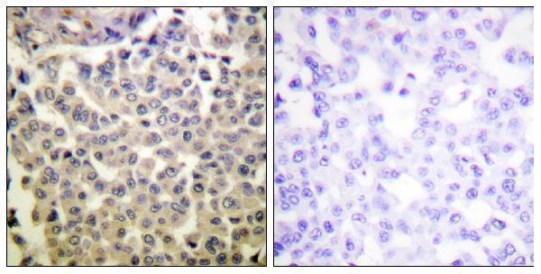 a00454t423 pak1 primary antibodies ihc testing 1