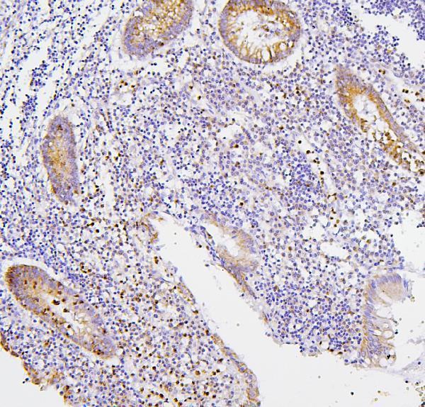  IHC analysis of CXCR2 using anti-CXCR2 antibody (A00455-2)