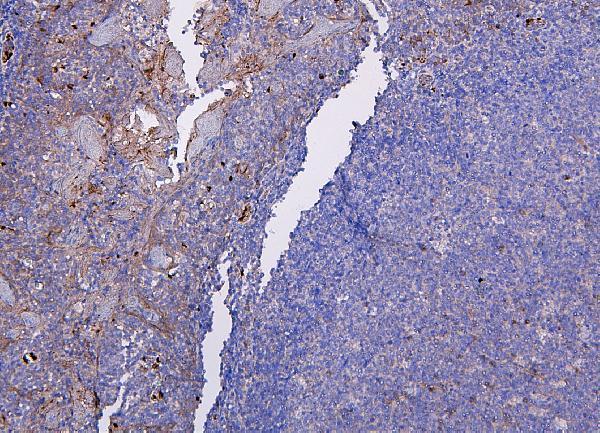 a00455 2 cxcr2 primary antibodies ihc testing 3