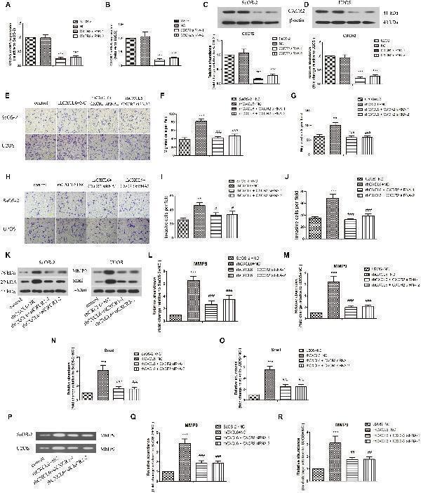 CXCL6/CXCR2 axis contributed to migration and invasion of OS cells