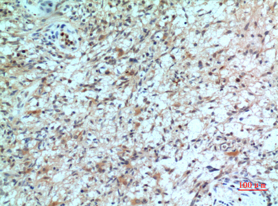 Immunohistochemistry validation of CXCR2 using Anti-IL8 beta CXCR2 Antibody (A00455)