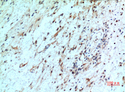 Immunohistochemistry validation of CXCR2 using Anti-IL8 beta CXCR2 Antibody (A00455)