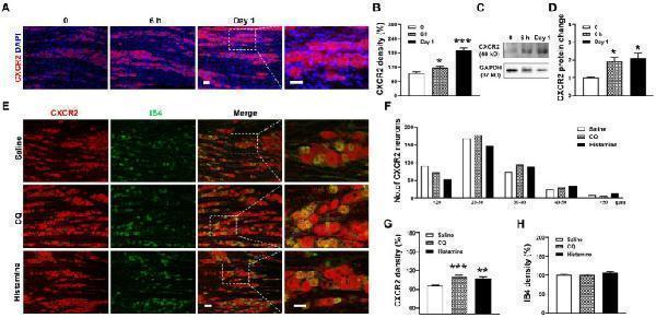Upregulation of the expression of CXCR2 protein in TG in orofacial itch