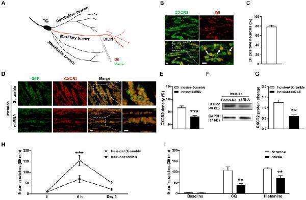 DION microinjection and effects of CXCR2 shRNA on orofacial itch