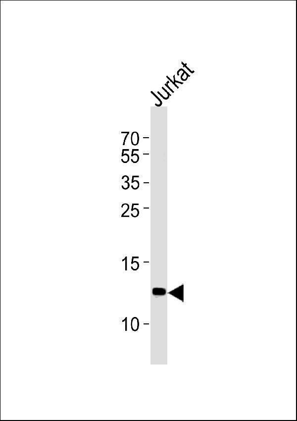 B2M Antibody (C-term) western blot analysis in Jurkat cell line lysates (35ug/lane)