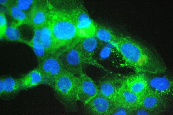 a00456 1 b2m primary antibodies if testing 4_1