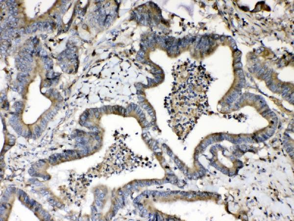  IHC analysis of Beta 2 Microglobulin using anti- Beta 2 Microglobulin antibody (A00456-1)