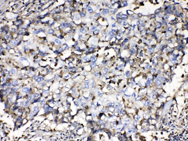  IHC analysis of Beta 2 Microglobulin using anti- Beta 2 Microglobulin antibody (A00456-1)