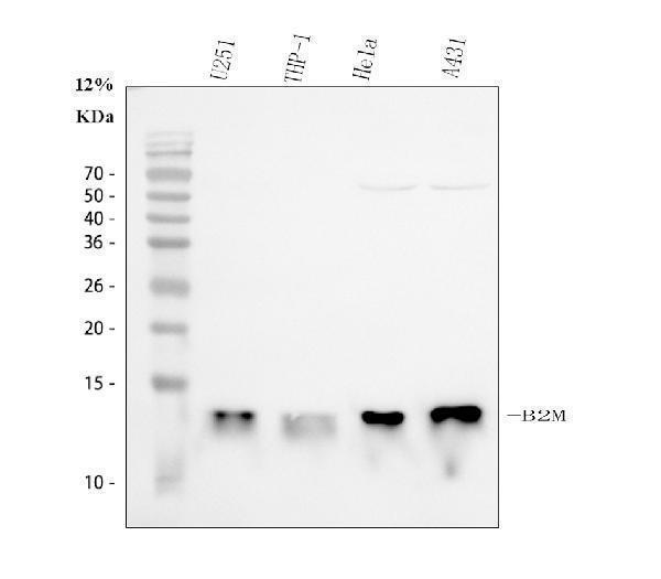  Western blot analysis of Beta 2 Microglobulin using anti-Beta 2 Microglobulin antibody (A00456-1)