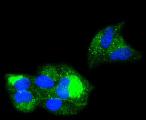 ICC staining beta 2 Microglobulin in Hela cells (green)