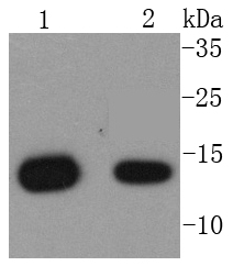 Western blot analysis of beta 2 Microglobulin on different lysates using anti-beta 2 Microglobulin antibody at 1/1,000 dilution