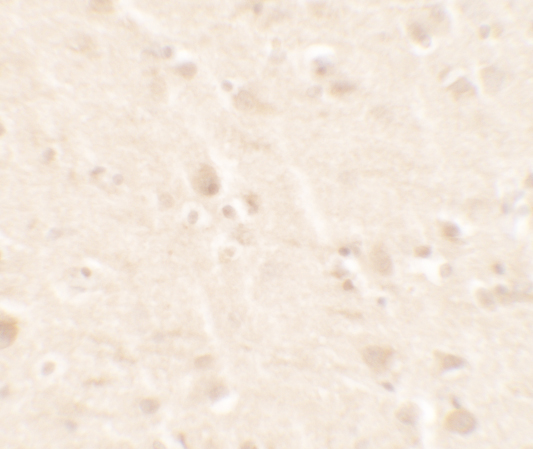 Immunohistochemistry of B2M in mouse brain tissue with B2M antibody 5 μg/mL