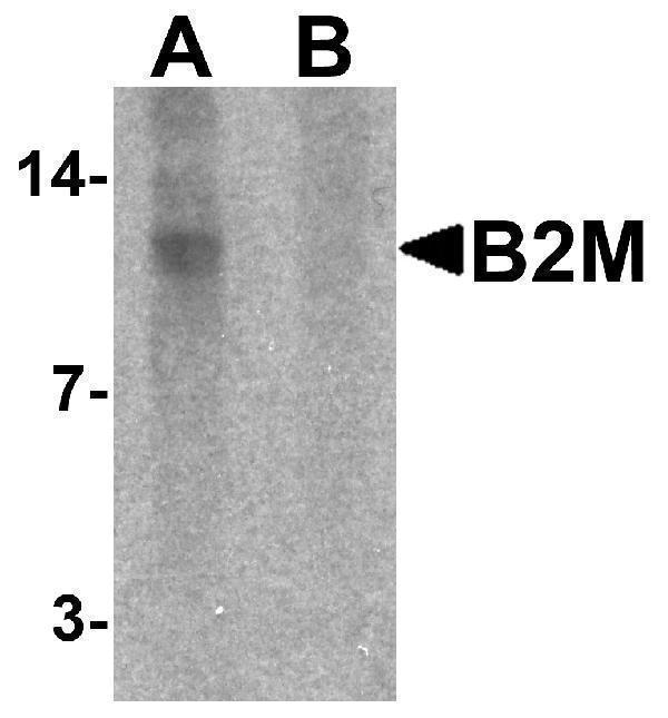 Western blot analysis of B2M in SK-N-SH cell lysate with B2M antibody at 1 μg/mL in (A) the absence and (B) the presence of blocking peptide