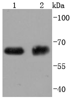 Western blot analysis of ABCG2 on different lysates using anti-ABCG2 antibody at 1/1,000 dilution