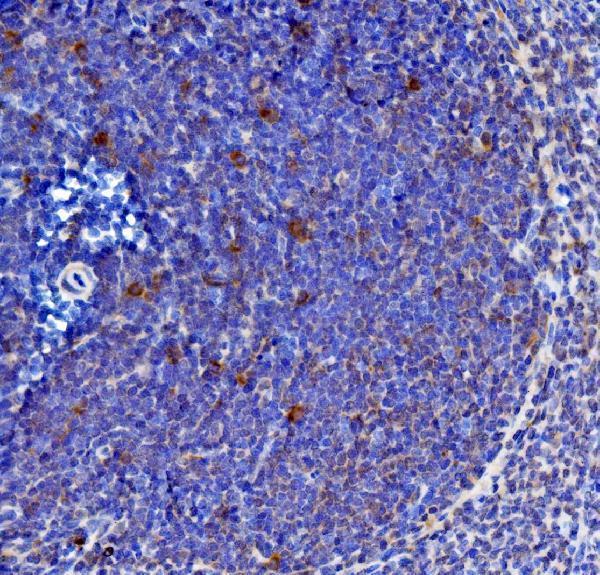 a00459 1 il21 primary antibodies ihc testing 2
