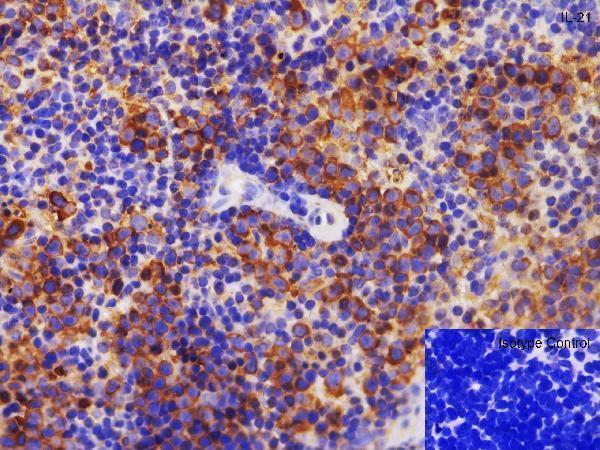 a00459 il21 primary antibodies ihc testing 4
