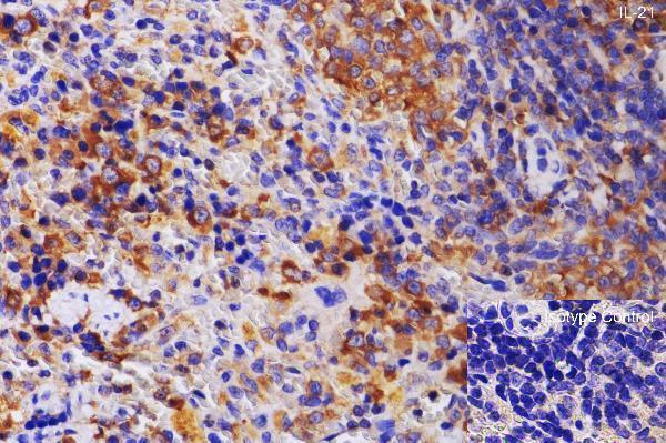 a00459 il21 primary antibodies ihc testing 5