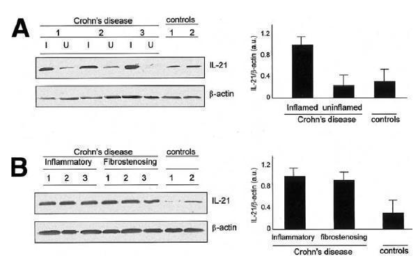 a00459 il21 primary antibodies wb testing 6