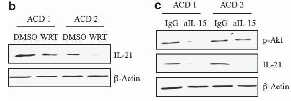 a00459 il21 primary antibodies wb testing 7