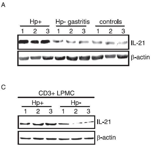 a00459 il21 primary antibodies wb testing 8