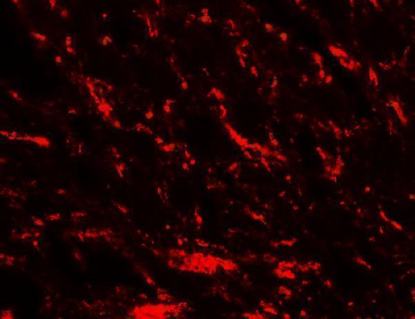 Immunofluorescence of MFN2 in rat brain tissue with MFN2 antibody at 20 μg/mL