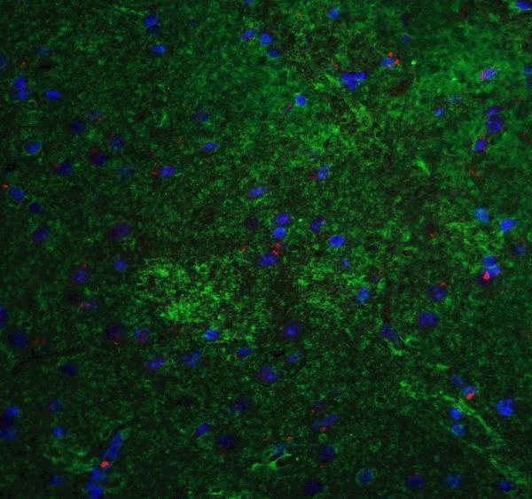 a00461 mfn2 primary antibodies if testing 4