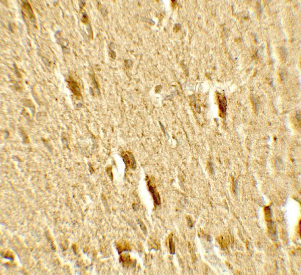 Immunohistochemistry of MFN2 in rat brain tissue with MFN2 antibody at 5 μg/mL