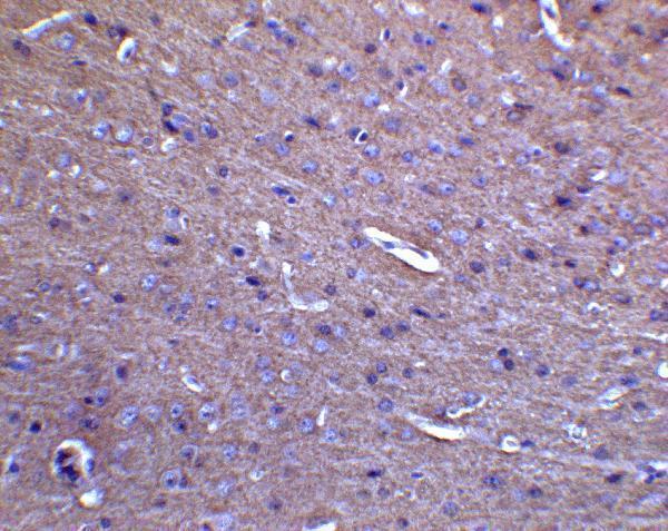 a00461 mfn2 primary antibodies ihc testing 5