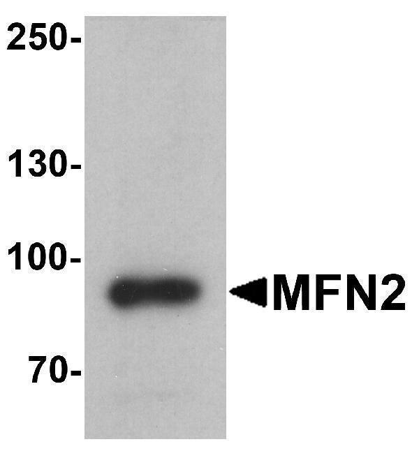 Western blot analysis of MFN2 in human brain tissue lysate with MFN2 antibody at 1 μg/ml