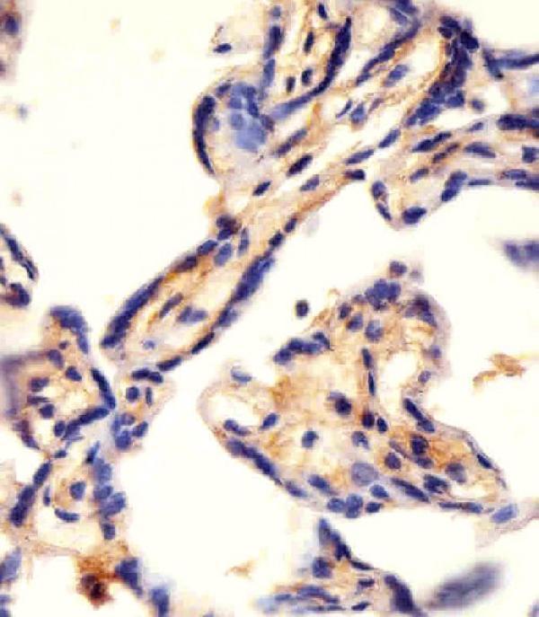 a00463 3 anti cad antibody center ihc p testing 6