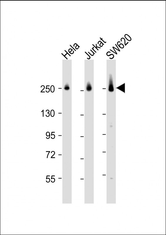 a00463 3 anti cad antibody center wb testing 1