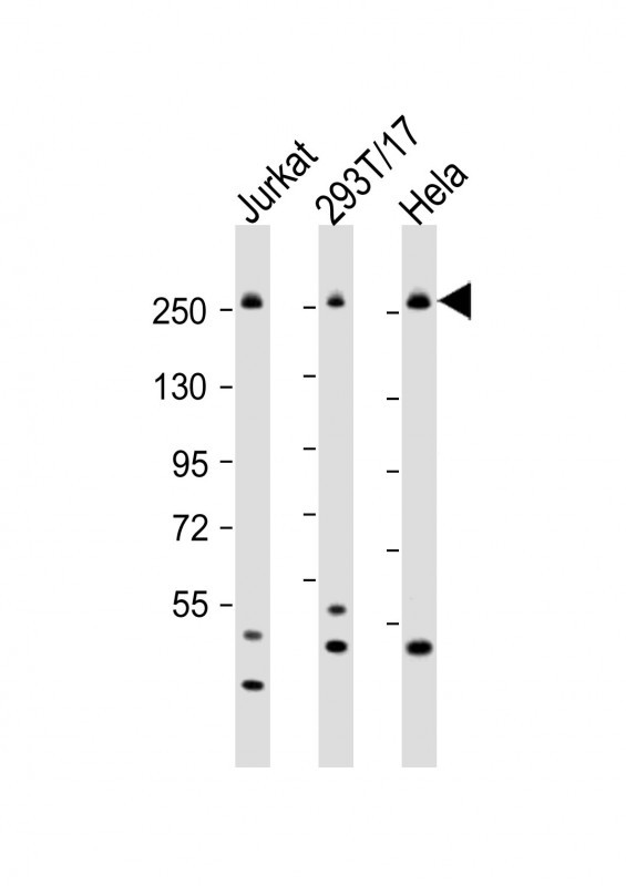 a00463 3 anti cad antibody center wb testing 3