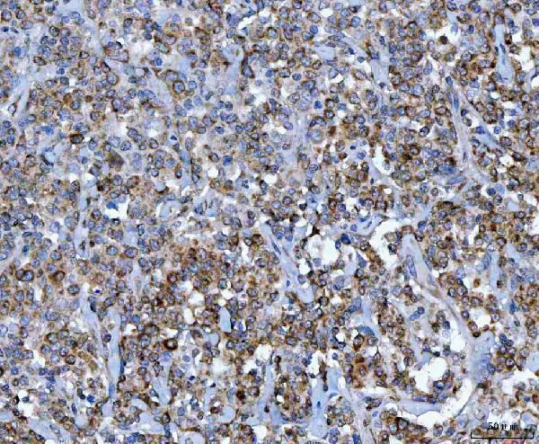  IHC analysis of CAD using anti-CAD antibody (A00463-4)