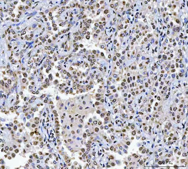  IHC analysis of CAD using anti-CAD antibody (A00463-4)