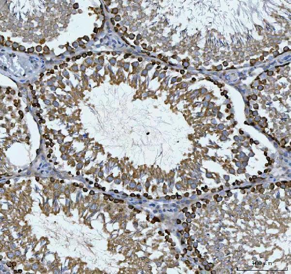 a00463 4 cad primary antibodies ihc testing 8