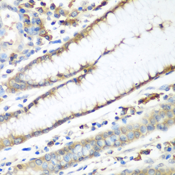 a00463 cad primary antiboties ihc testing 3