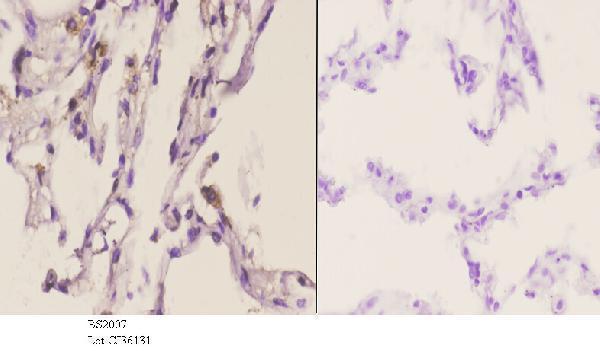 a00466s63 tnfsf10 primary antiboties ihc testing 3