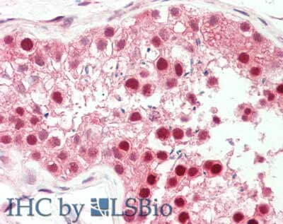 a00467 pin1 primary antibodies ihc testing 1