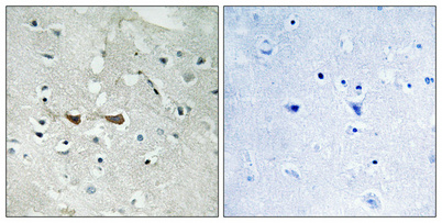 Immunohistochemical analysis of paraffin-embedded Human brain
