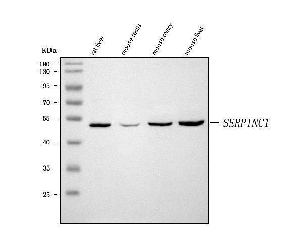  Western blot analysis of Antithrombin III/SERPINC1 using anti-Antithrombin III/SERPINC1 antibody (A00469-1)