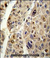 a00469 anti serpinc1 antibody c term ihc p testing 4