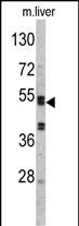 Western blot analysis of SERPINC1 Antibody (C-term) (Cat