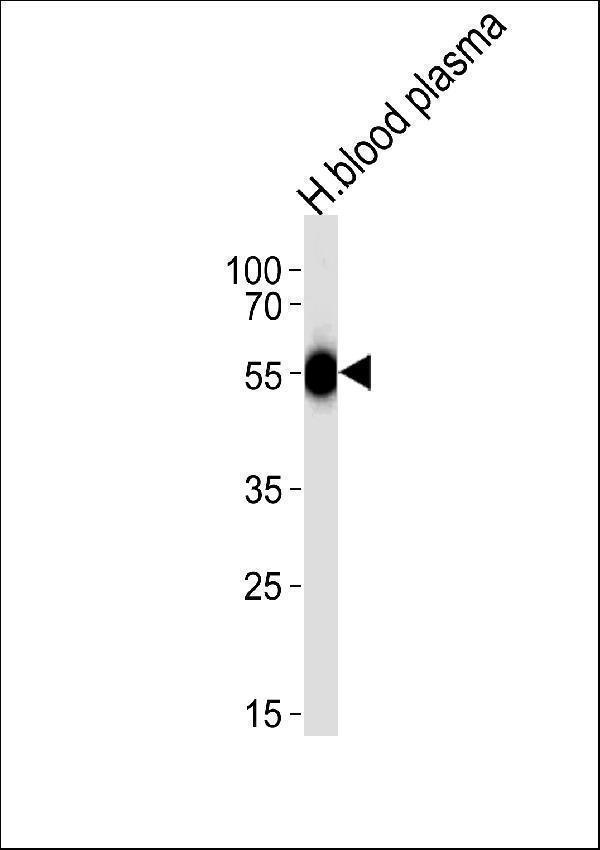 Western blot analysis of lysate from human blood plasma tissue lysate, using SERPINC1 Antibody (C-term) (Cat