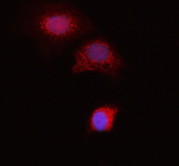 a00470 galectin 1 primary antibodies if testing 1