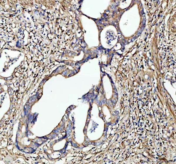 a00470 galectin 1 primary antibodies ihc testing 1
