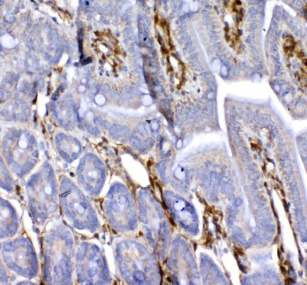 a00470 galectin 1 primary antibodies ihc testing 2