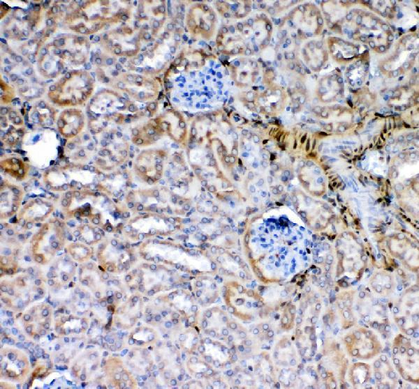 a00470 galectin 1 primary antibodies ihc testing 3