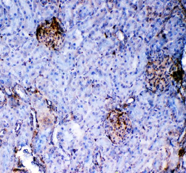 a00470 galectin 1 primary antibodies ihc testing 4